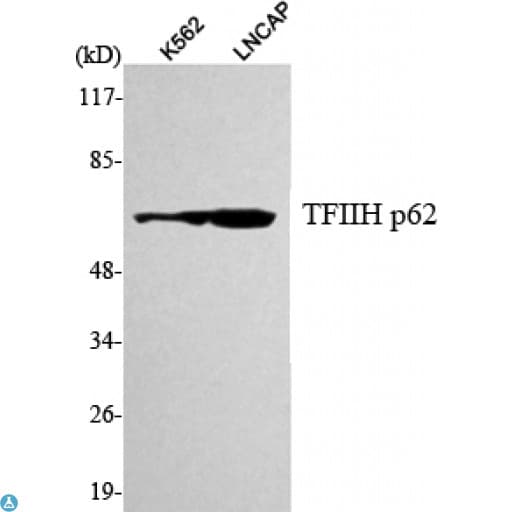 TFB1 / GTF2H1 Antibody