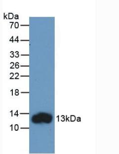 FABP1 / L-FABP Antibody