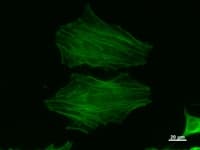 ACTB / Beta Actin Antibody (clone ACTBD11B7)
