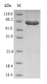 Human RASSF6 Protein (Recombinant GST, N-terminus)
