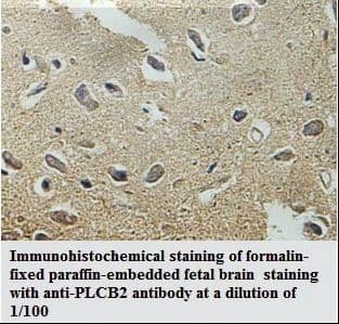 PLCB2 Antibody (aa1-198)