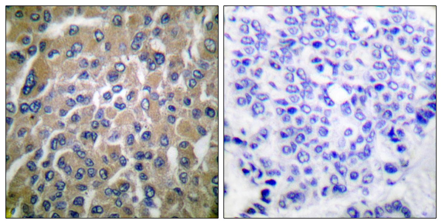 CGB / hCG Beta Antibody