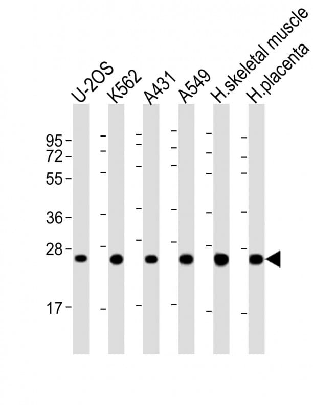 UQCRFS1 Antibody (aa71-104)