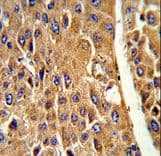 Polyclonal Rabbit anti-Human CYP3A5 Antibody (aa186-218, IHC, WB)