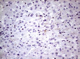 NBN / Nibrin Antibody (clone OTI6E11)