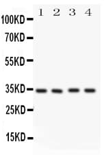 CASP7 / Caspase 7 Antibody (aa237-255)