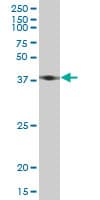 IHC-plus™ Monoclonal Mouse anti-Human ACTB / Beta Actin Antibody (clone 1E7, IHC, WB)