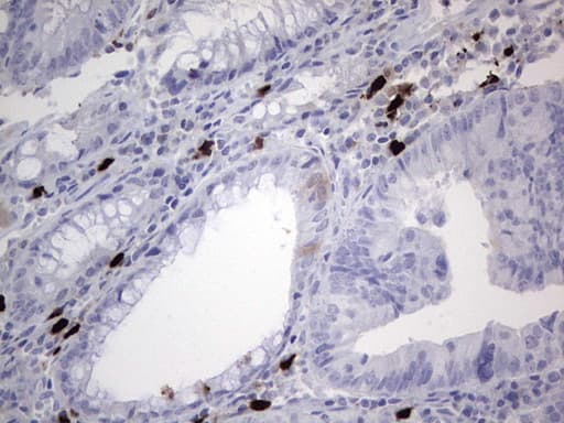 p16INK4a / CDKN2A Antibody (clone OTI5H5)
