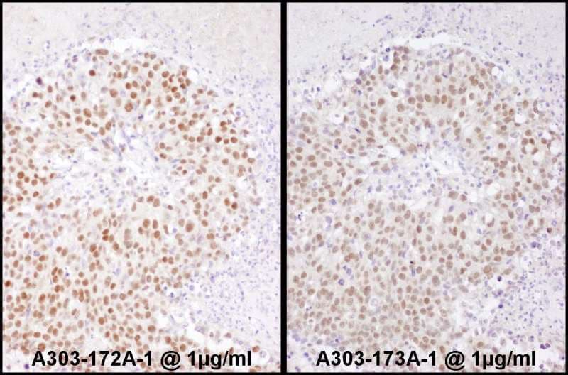 Polyclonal Rabbit anti-Human SRF / Serum Response Factor Antibody (aa25-75, IHC, WB)