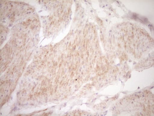 Monoclonal Mouse anti-Human TRB3 / TRIB3 Antibody (clone OTI3C6, aa1-200, IHC, WB)