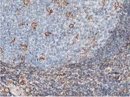 Latexin / MUM Antibody (clone OTI1E10)