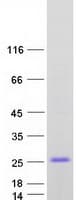 Human CSRP3 Protein (Recombinant Myc-DDK (Flag))