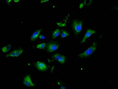 NLGN3 / Neuroligin 3 Antibody