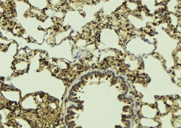 Polyclonal Rabbit anti-Human SIAH2 Antibody (IHC, IF, WB)