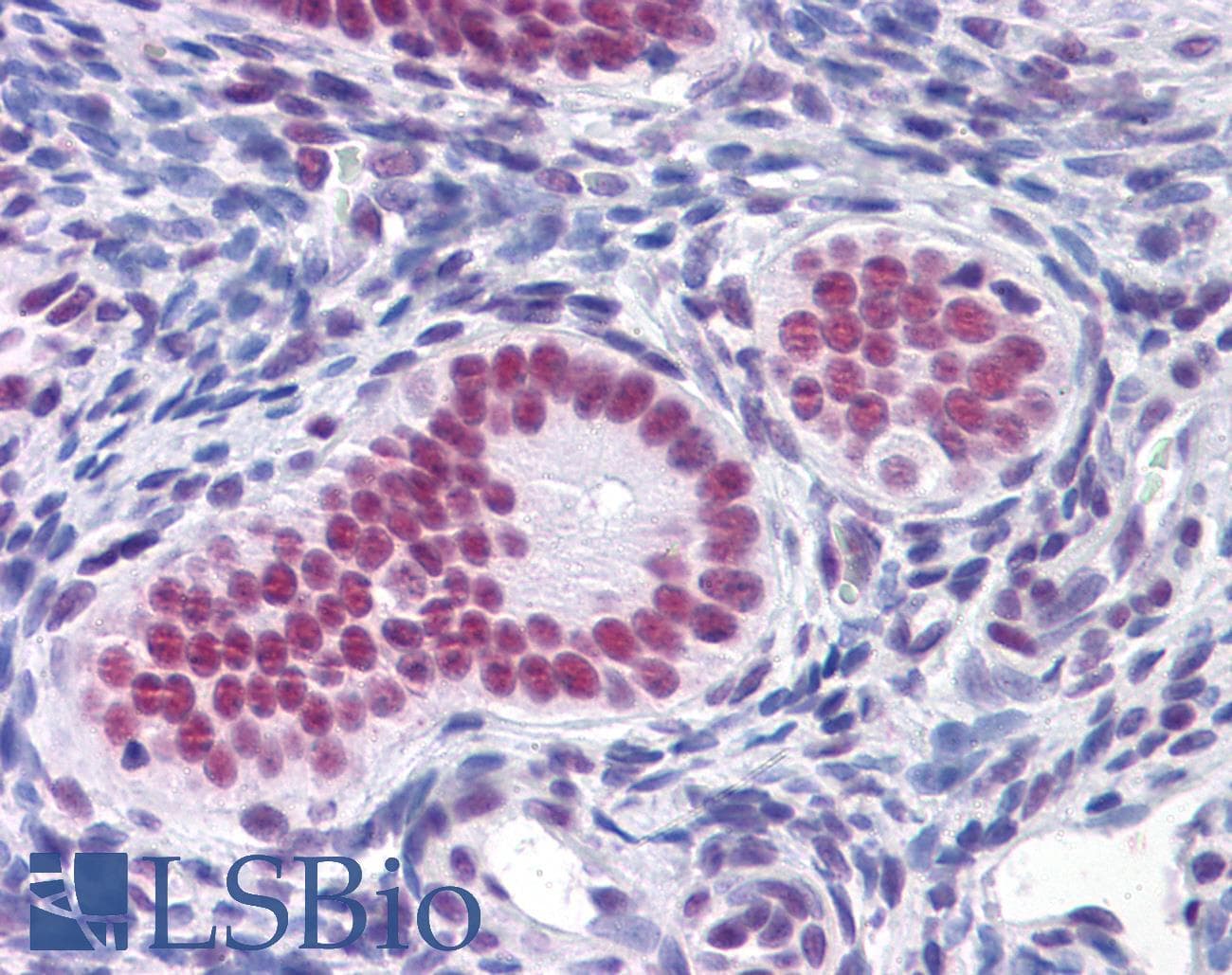 IHC-plus™ CBFA1 / RUNX2 Antibody (clone 1D8)