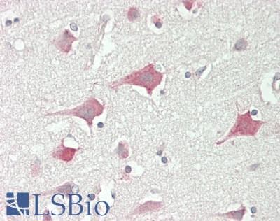 IHC-plus™ ATP2B2 / PMCA2 Antibody (Internal)