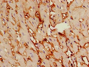 Polyclonal Rabbit anti-Human TSR2 Antibody (IHC, IF, WB)
