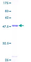 Human MYL4 Protein (Recombinant GST)