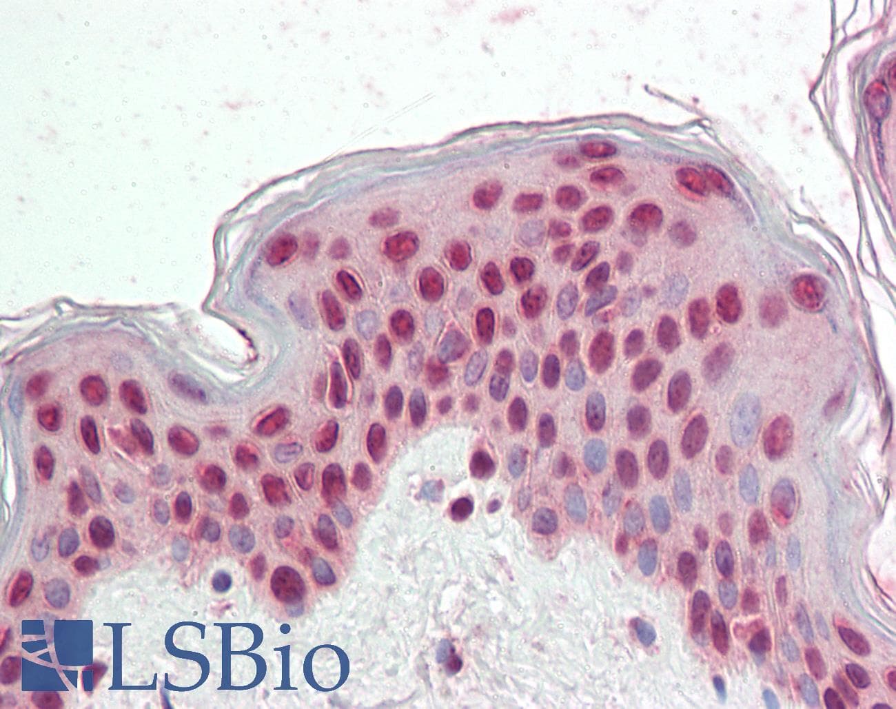 PathPlus™ CDKN1C / p57 Kip2 Antibody