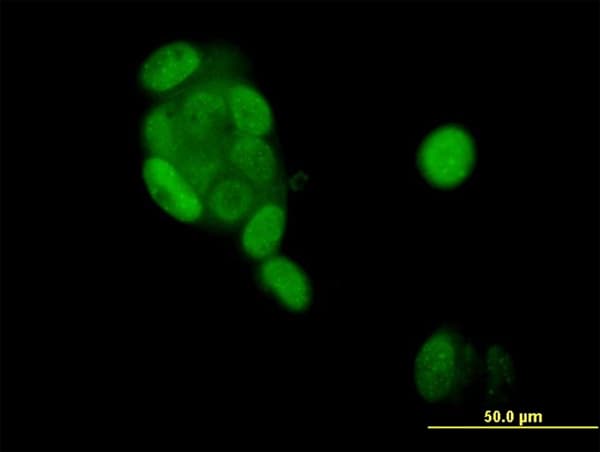 Monoclonal Mouse anti-Human PR / Progesterone Receptor Antibody (clone 4E9, IHC, IF, WB)