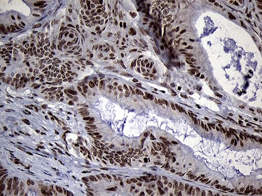 Monoclonal Mouse anti-Human SPANXB1 Antibody (clone OTI6G2, IHC, WB)