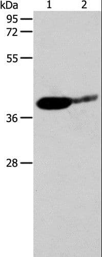 Polyclonal Rabbit anti-Human SIRT3 / Sirtuin 3 Antibody (IHC, WB)