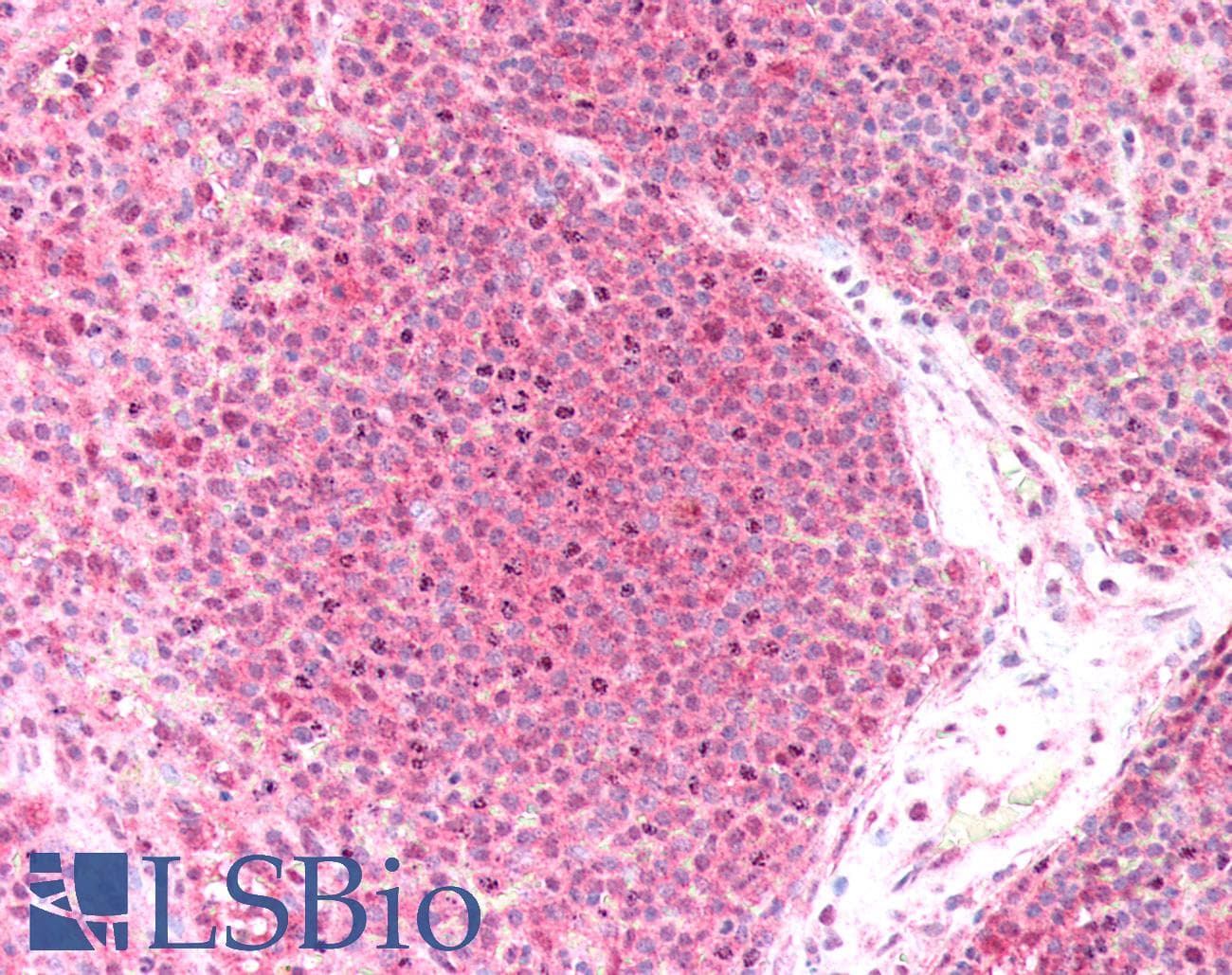IHC-plus™ Polyclonal Rabbit anti-Human CRBN / Cereblon Antibody (IHC, WB)