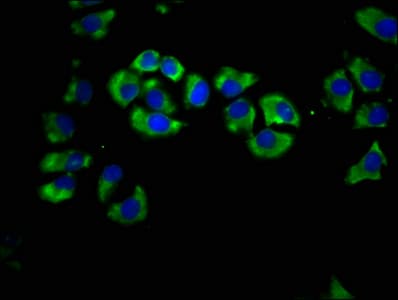 LIPH / Lipase Member H Antibody