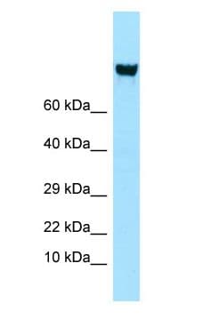 ITGAV/Integrin Alpha V/CD51 Antibody (C-Terminus)