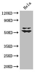 Polyclonal Rabbit anti-Human KLF5 / BTEB2 Antibody (WB)