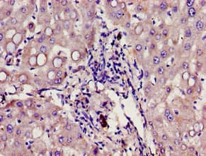 Polyclonal Rabbit anti-Human Growth Hormone Receptor / GHR Antibody (IHC)