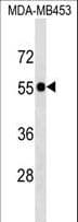 Polyclonal Rabbit anti-Human SCLY Antibody (aa8-36, WB)