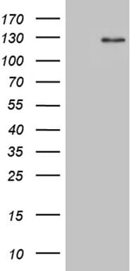 Monoclonal Mouse anti-Human DACT1 / DAPPER Antibody (clone OTI13H4, aa289-555, WB)