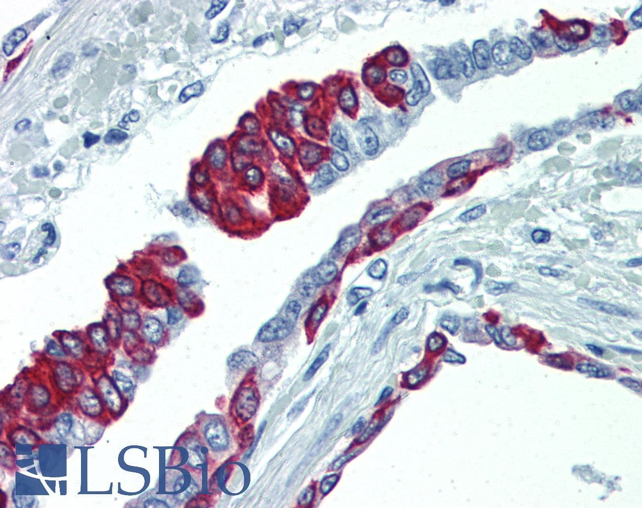 PathPlus™ KRT17 / CK17 / Cytokeratin 17 Antibody (C-Terminus, clone V21-R)