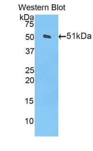 CPT1A Antibody (aa568-773)
