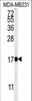 Polyclonal Rabbit anti-Human AP1S1 Antibody (aa5-34, IHC, WB)