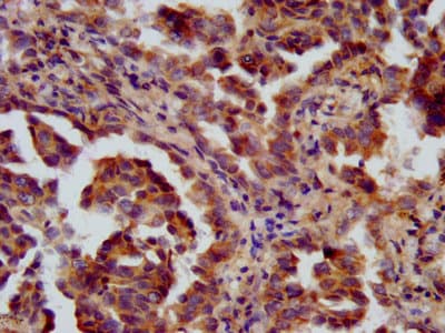 PHF9 / FANCL Antibody