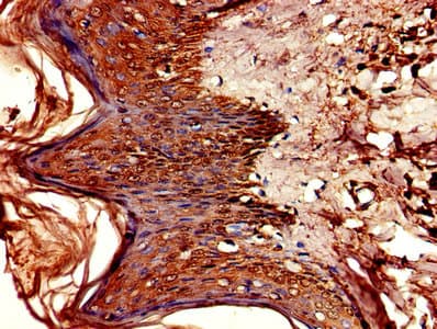 CSF2RA / CD116 Antibody (aa23-320)