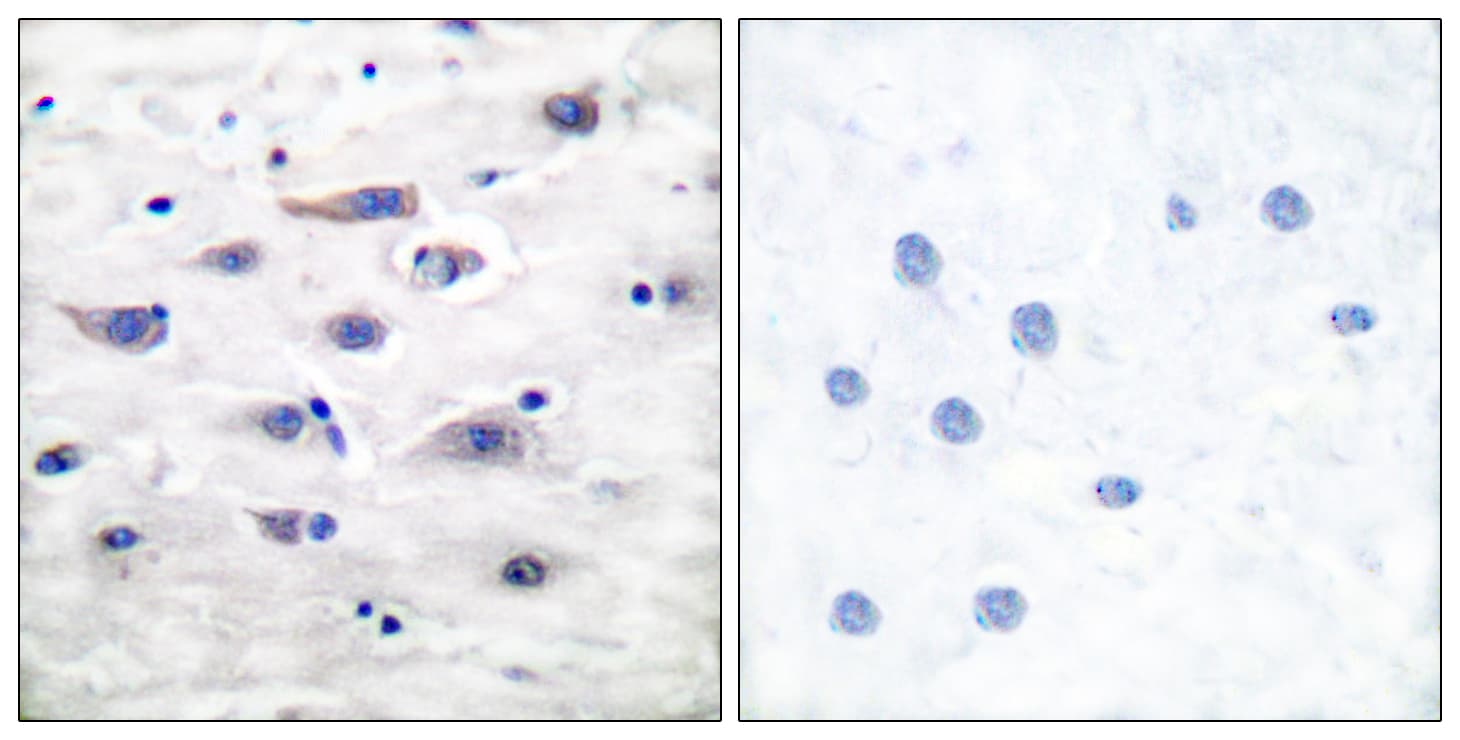 GRIA1 / GLUR1 Antibody (aa829-878)