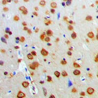 AKT1 Antibody (C-Terminus)