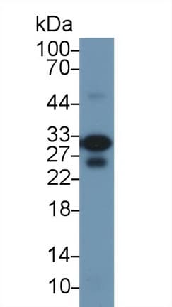 TNNI3 / Cardiac Troponin I Antibody (aa1-211)