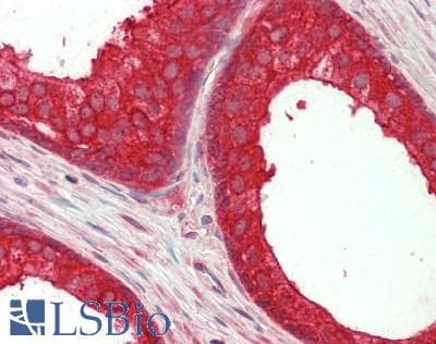 IHC-plus™ NEDD4L / NEDD4-2 Antibody (aa275-325)