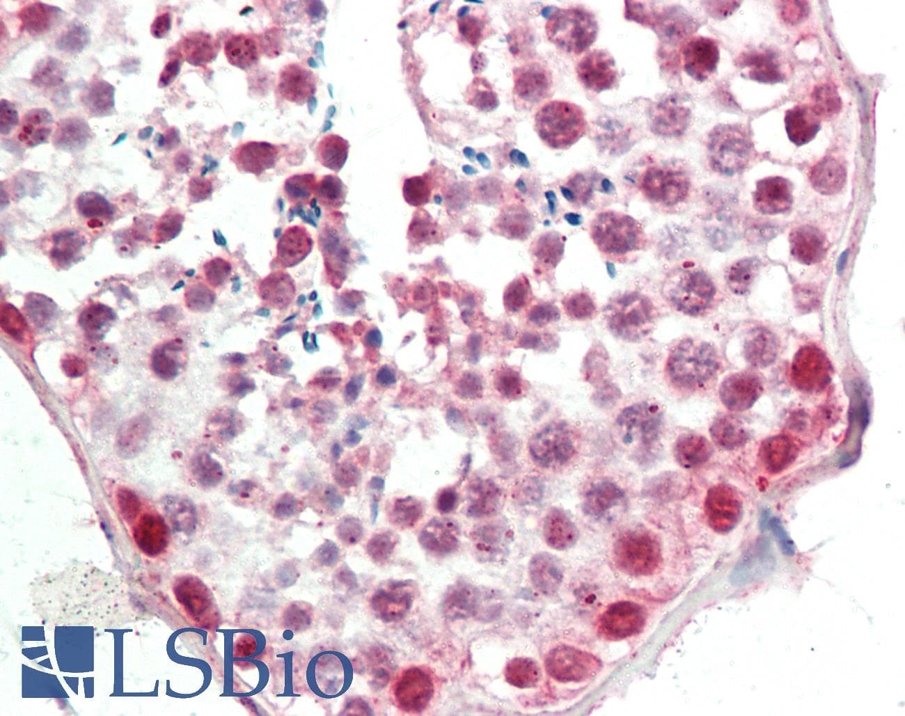 IHC-plus™ Polyclonal Rabbit anti-Human HSP90AA1 / Hsp90 Alpha A1 Antibody (K294, IHC, WB)