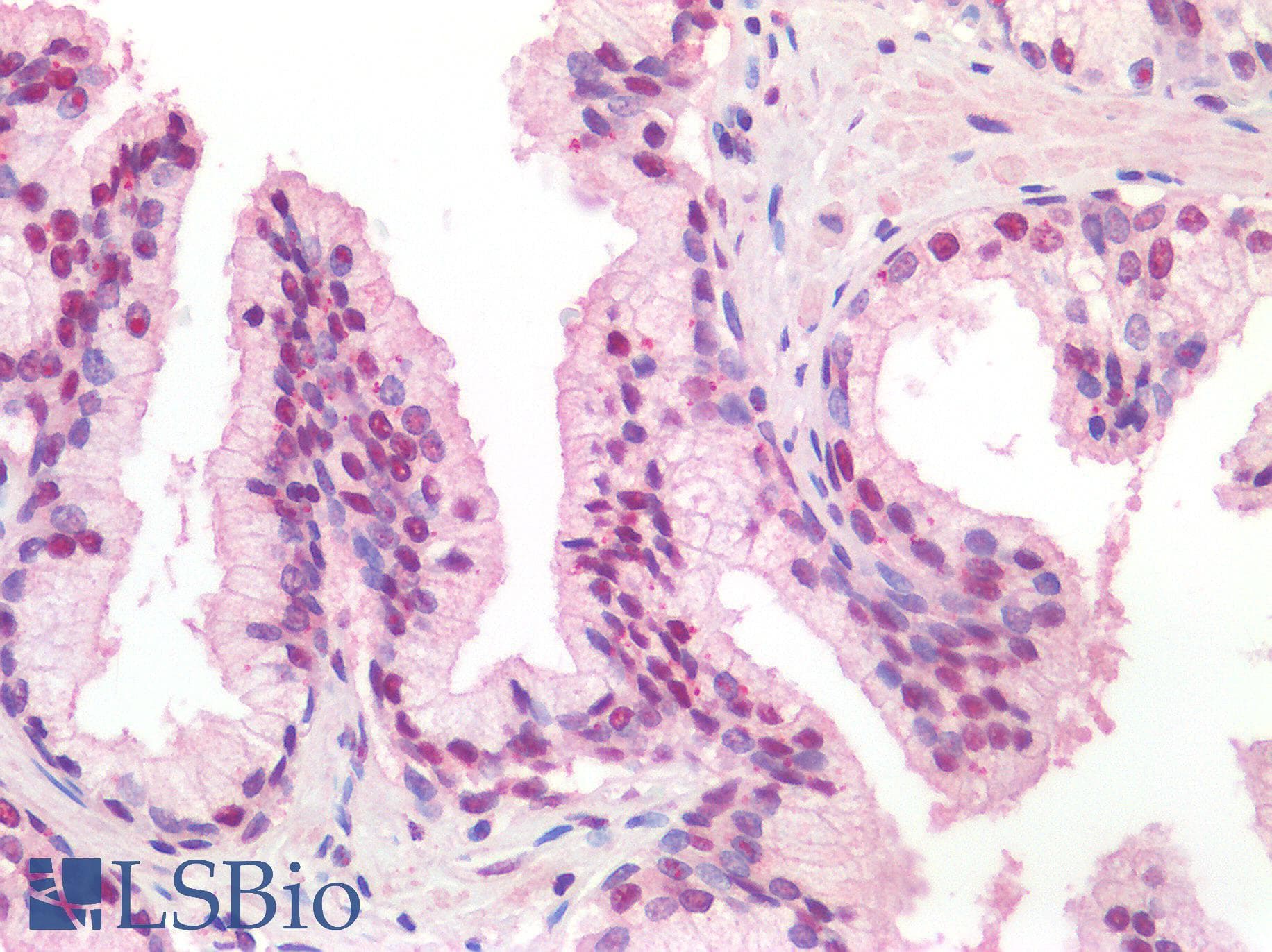 IHC-plus™ Polyclonal Goat anti-Human TICAM1 / TRIF Antibody (IHC)