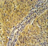 Polyclonal Rabbit anti-Human DYNC1LI2 Antibody (aa152-180, IHC, WB)