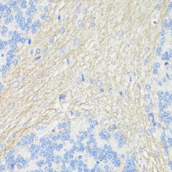 THY1 / CD90 Antibody