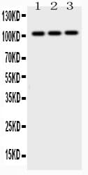 Polyclonal Rabbit anti-Human AP2B1 Antibody (WB)