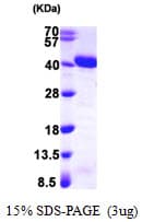 Human APEX1 / APE1 Protein (Recombinant T7)