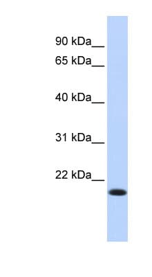 IRF7 Antibody (aa35-84)