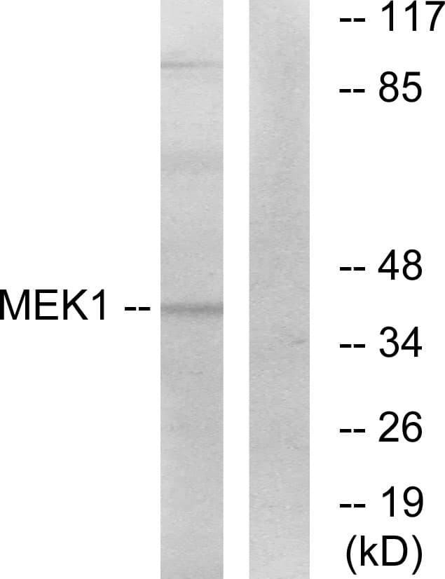 MAP2K1 / MKK1 / MEK1 Antibody (aa261-310)